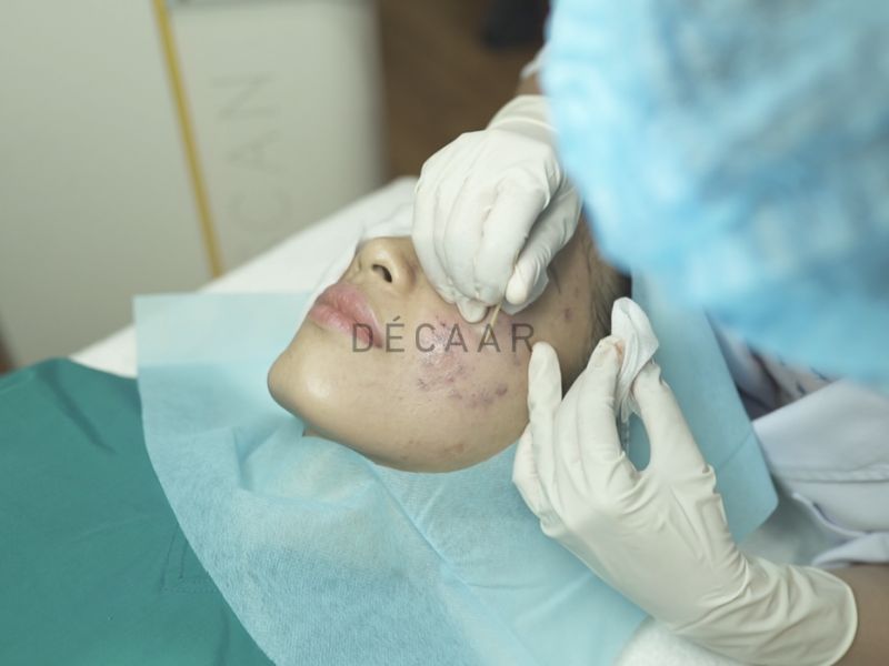 Ứng dụng TCA